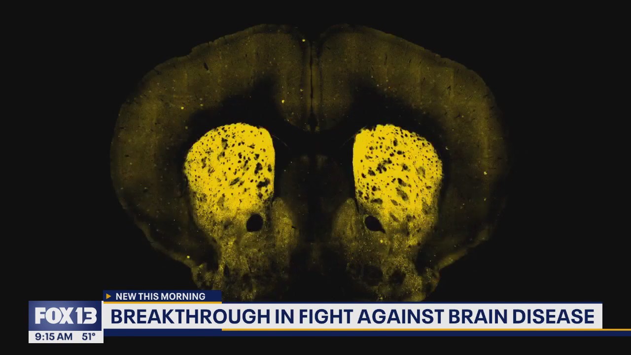 Breakthrough in fight against brain disease