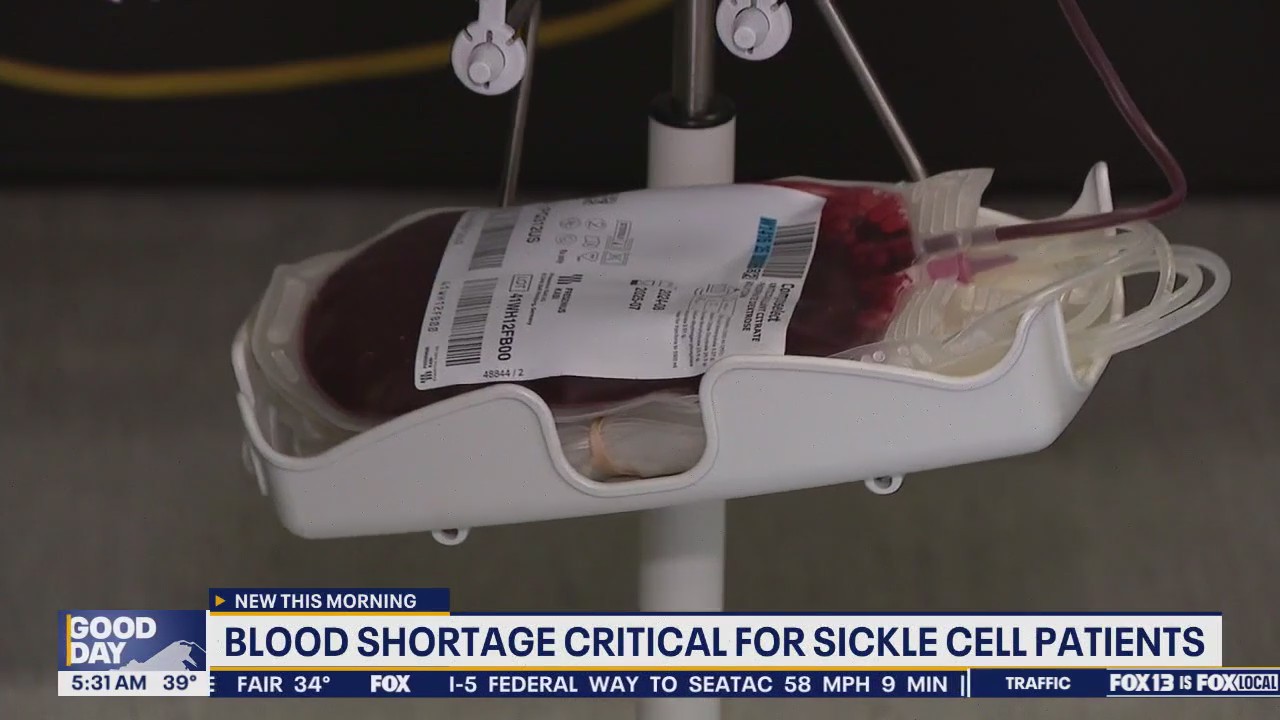 Blood shortage critical for sickle cell patients