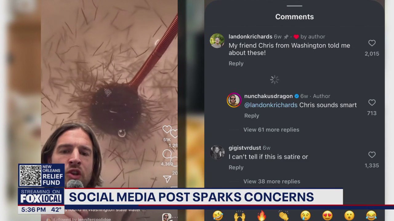 Social media post sparks parasite concerns
