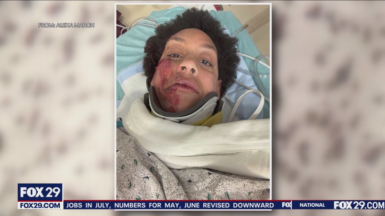Victim speaks out after tragic hit-and-run in South Philly