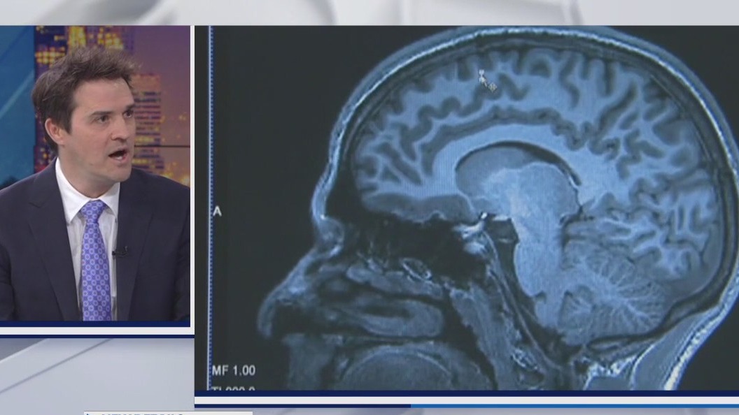 Dr. Vossel on new Alzheimer's drug