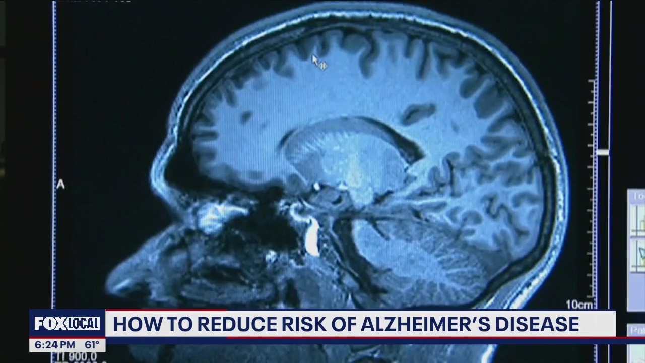 How to reduce risk of Alzheimer's disease