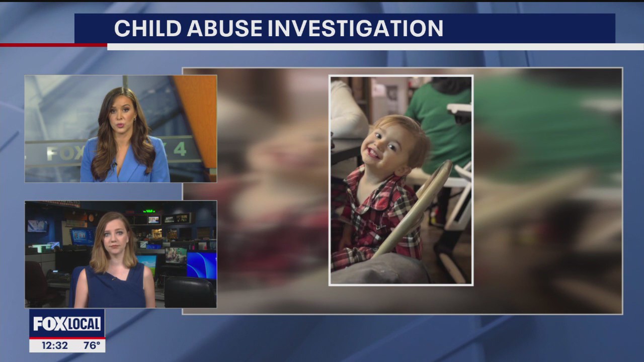PREVIOUS COVERAGE: McKinney toddler allegedly injured by mom's boyfriend