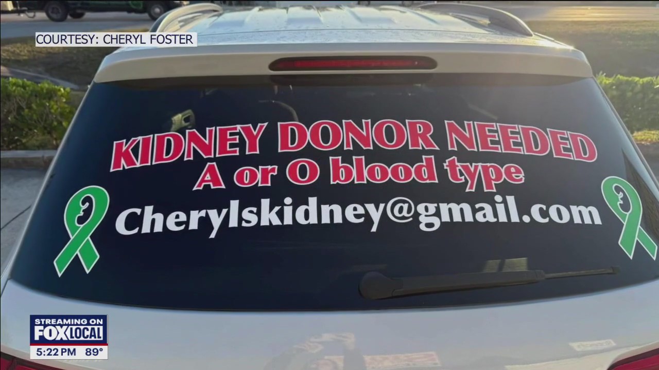 Co-workers bond over life-saving kidney donation