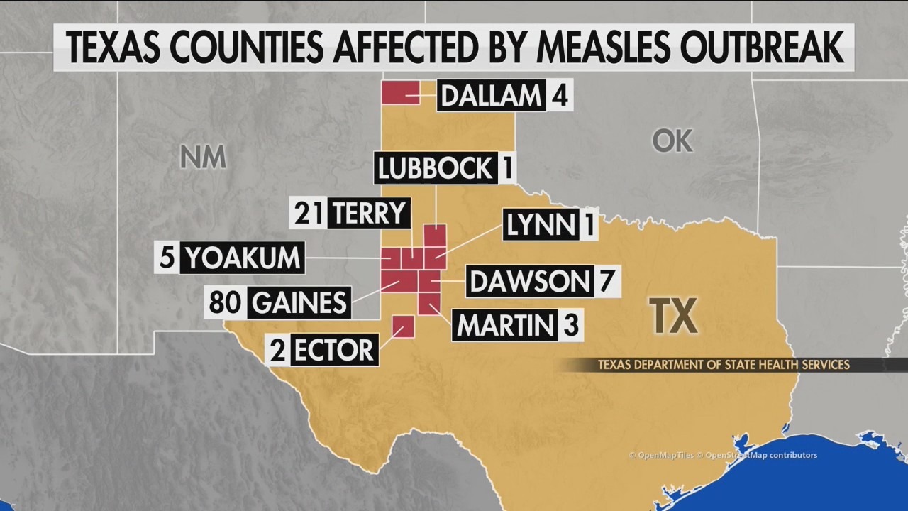 Measles outbreak: Dozens infected in Texas