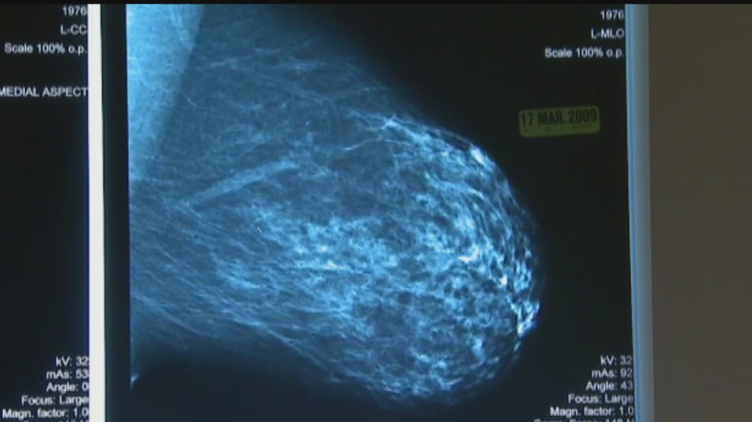 October marks National Breast Cancer Awareness Month