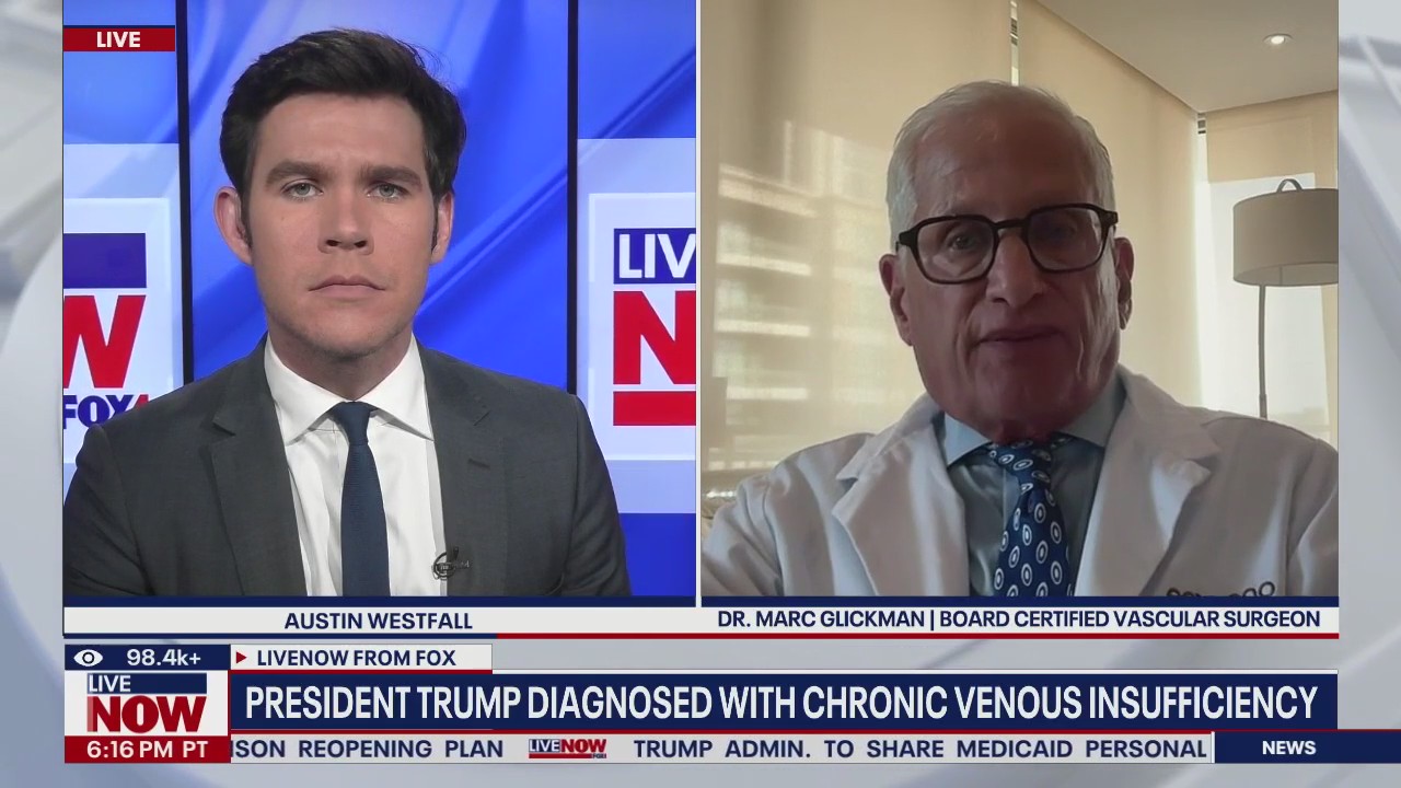 Trump diagnosed with chronic venous insufficiency