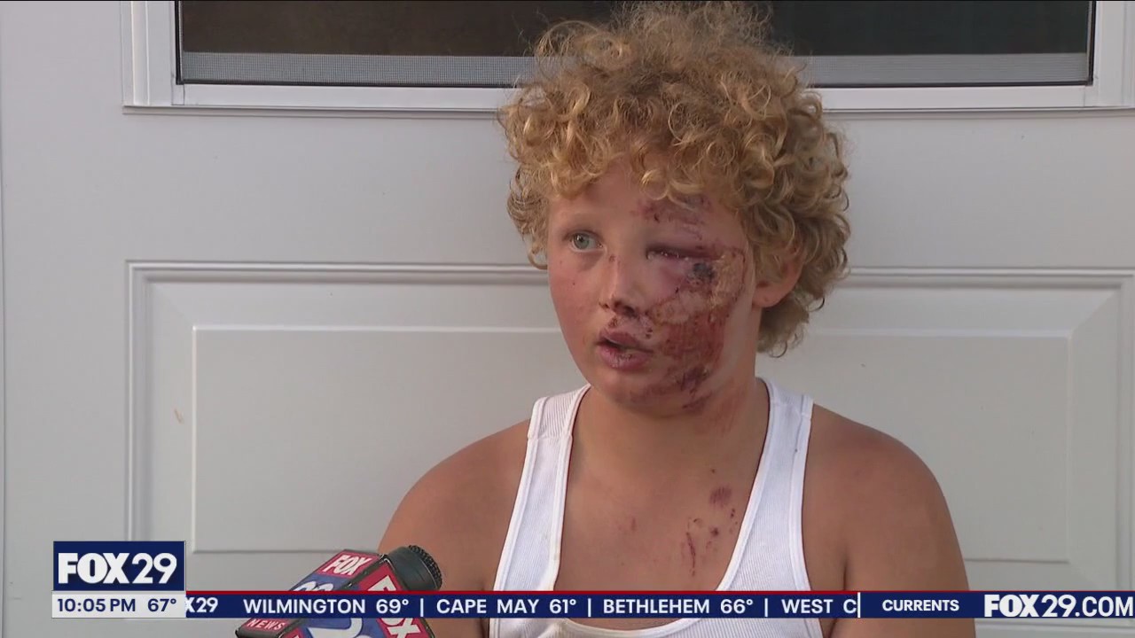 10-year-old boy badly injured in Bristol Twp. hit-and-run