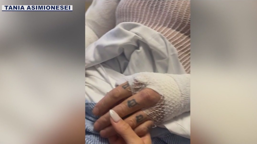 Phoenix house fire leaves father with severe burns