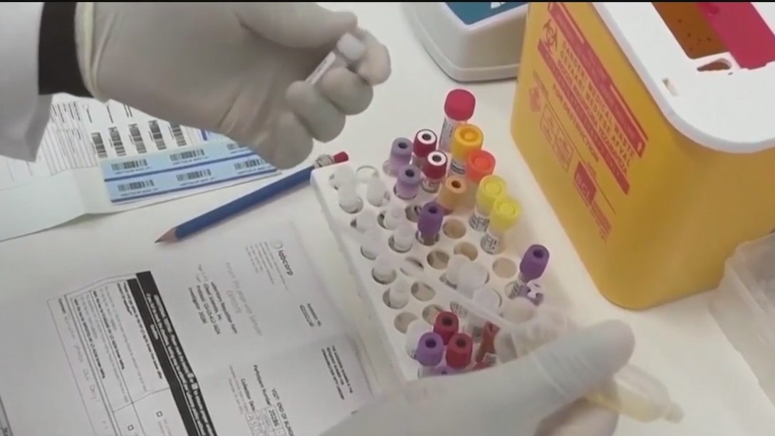 HIV treatment breakthrough