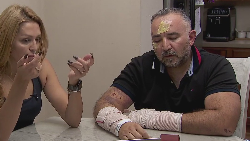Plymouth man recovering from dog attack