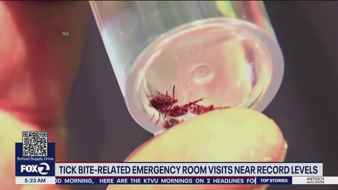Tick bite-related ER visits near record levels