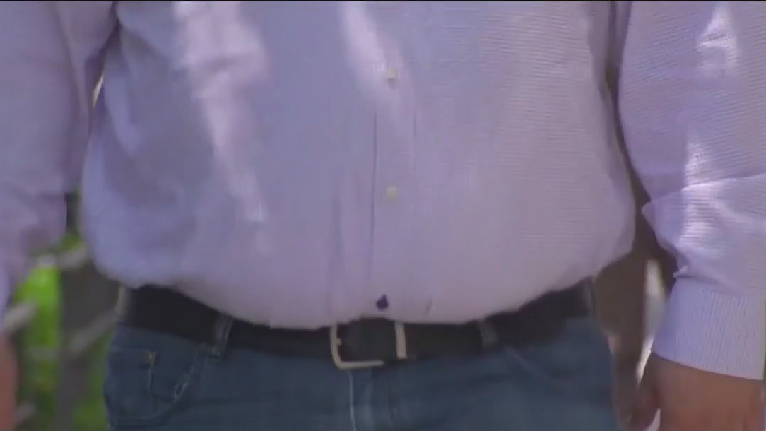 CDC says obesity rates decline in states