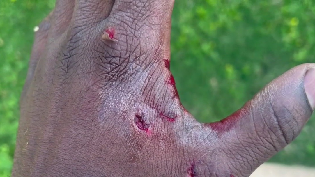 Houston man sues southwest side apartment complex claiming neighbor's dog attacked him