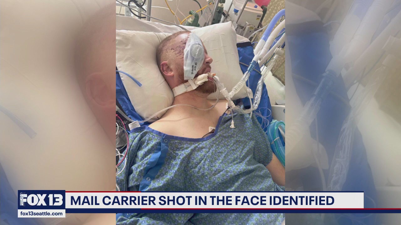Postal worker shot in face expected to lose eye; GoFundMe started