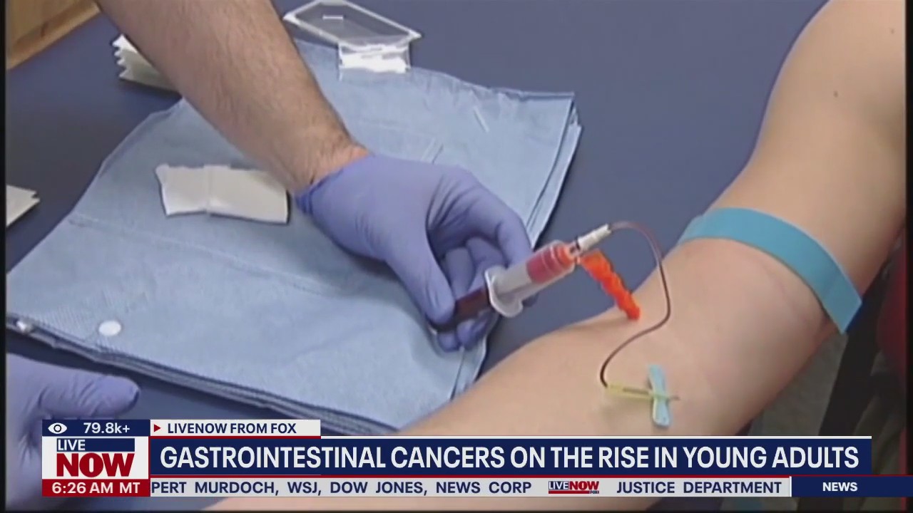 'Western diet' blamed for growing risk of GI cancers among young adults