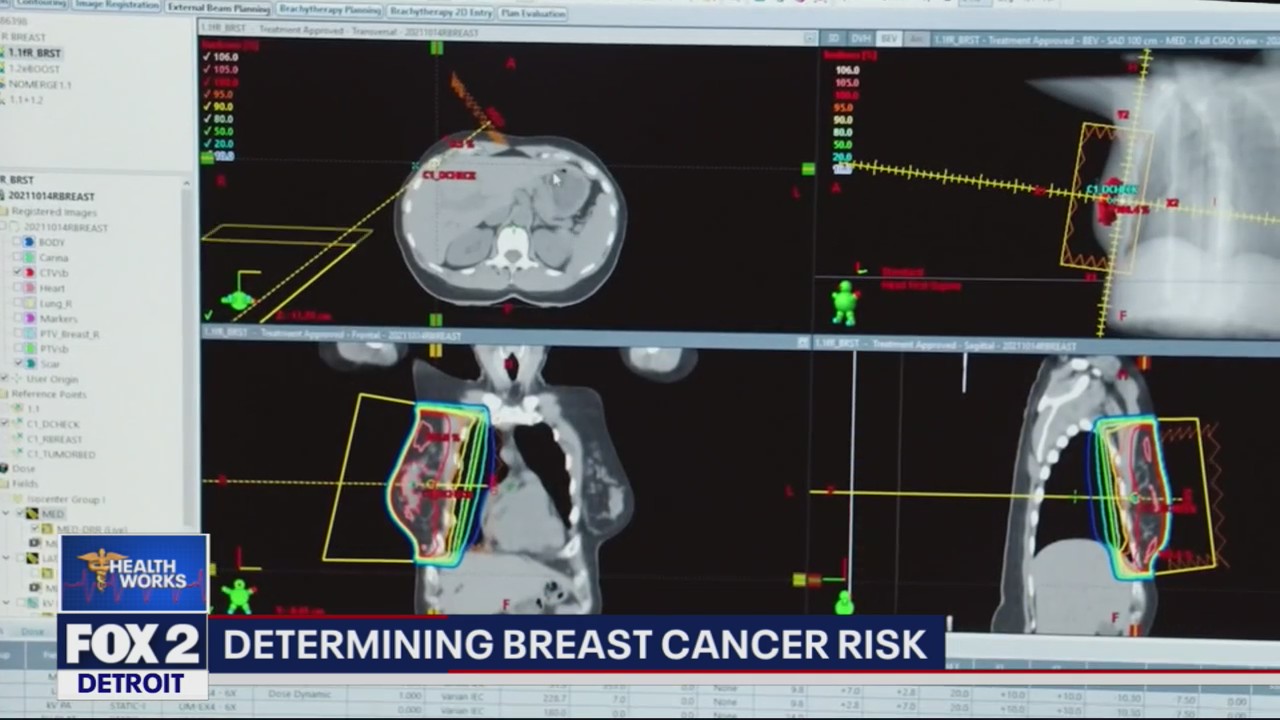 Breast cancer screening and early detection is key