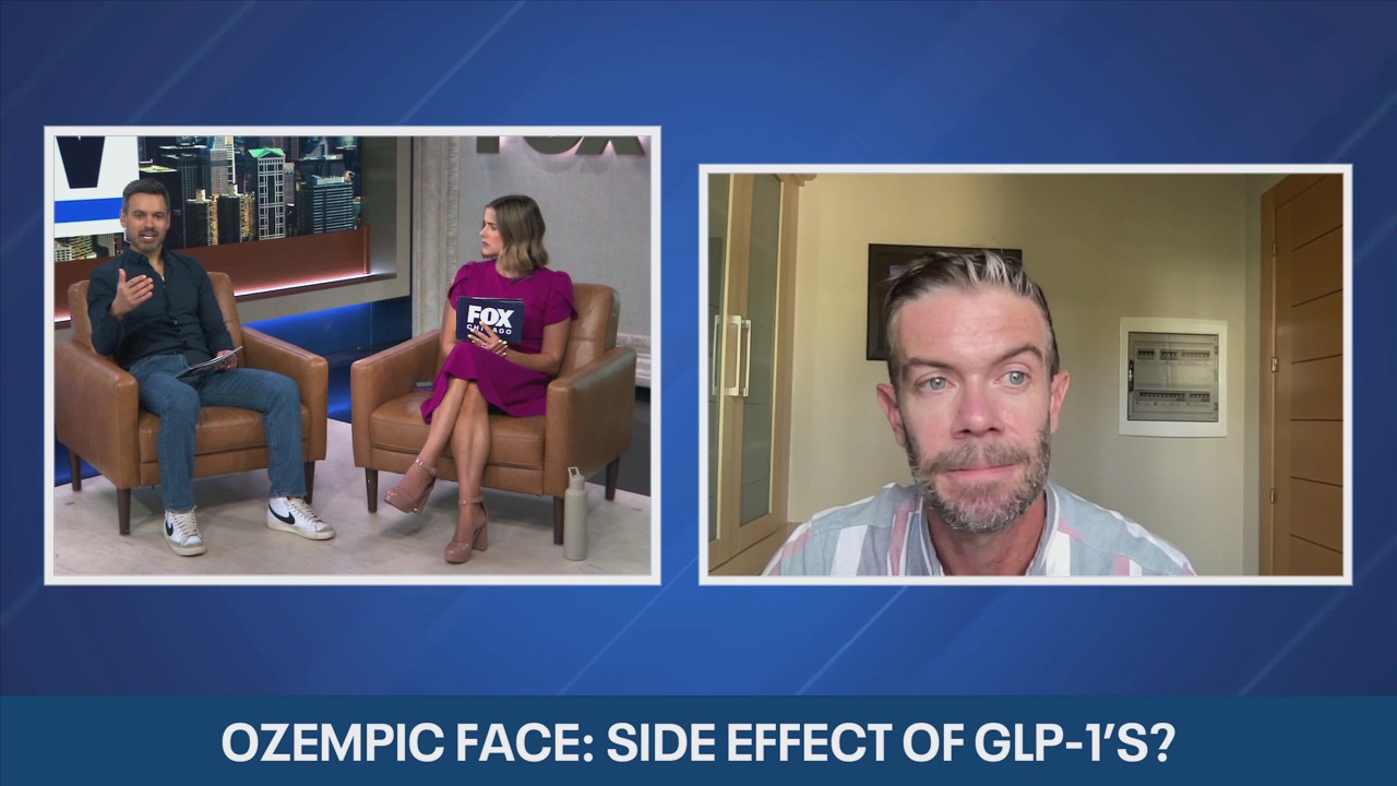 'Ozempic Face': Why weight loss drugs can make you look older | ChicagoNOW