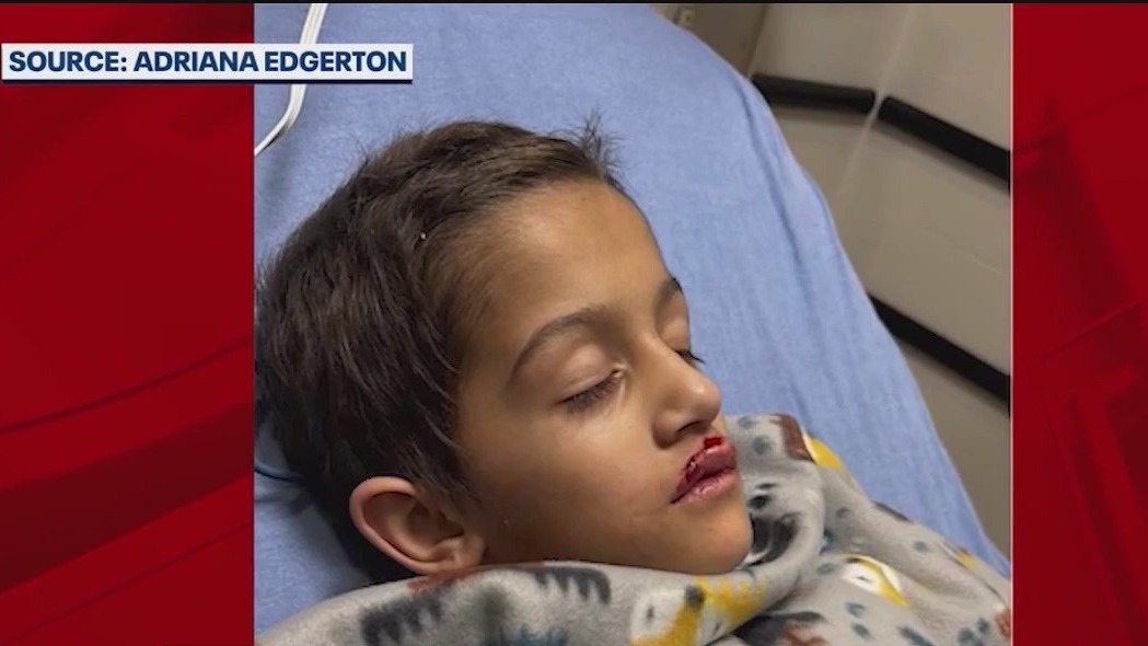 Family files lawsuit over son's injury in holiday drone show