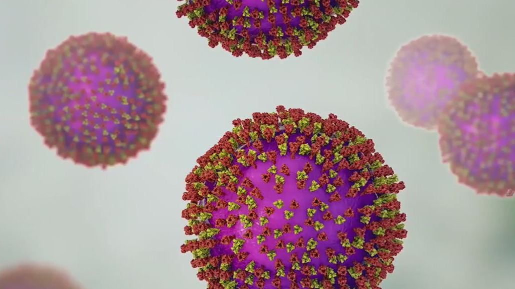 Bay Area health officials warn of possible measles exposures